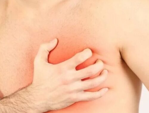 Боли при ишимической болезни сердца